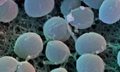 Preparat românesc care combate stafilococul auriu, premiat la Geneva