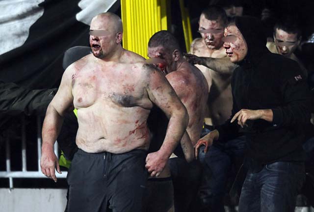 Ciomăgeală cu oase rupte între suporteri