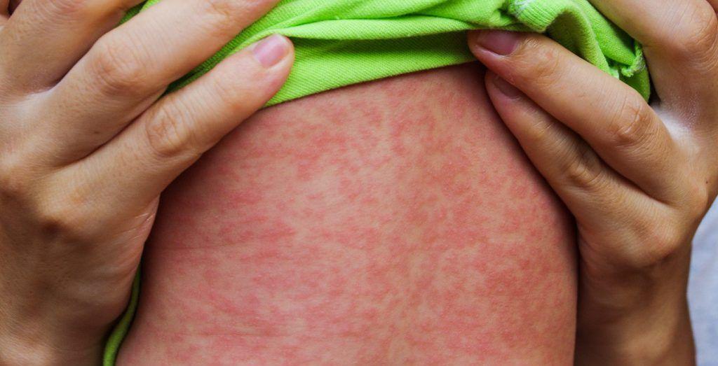 Luna aprilie, Luna Națională de Informare despre Vaccinare