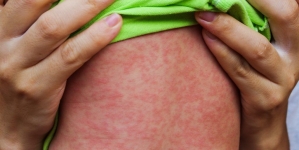 Luna aprilie, Luna Națională de Informare despre Vaccinare