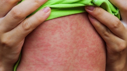 Luna aprilie, Luna Națională de Informare despre Vaccinare