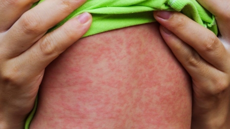 Luna aprilie, Luna Națională de Informare despre Vaccinare