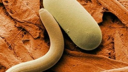 Emisiunea lunii decembrie: ”Feriți-vă de trichineloză”