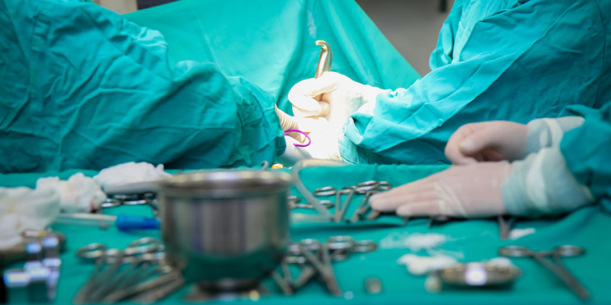 Tumoră cu diametru de 25 cm și greutate de 1,5 kg – extirpată la Spitalul Județean