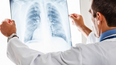 Medici pneumologi: 30% din persoanele vindecate de coronavirus vor avea o perioadă însemnată probleme respiratorii cronice