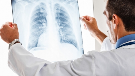 Medici pneumologi: 30% din persoanele vindecate de coronavirus vor avea o perioadă însemnată probleme respiratorii cronice