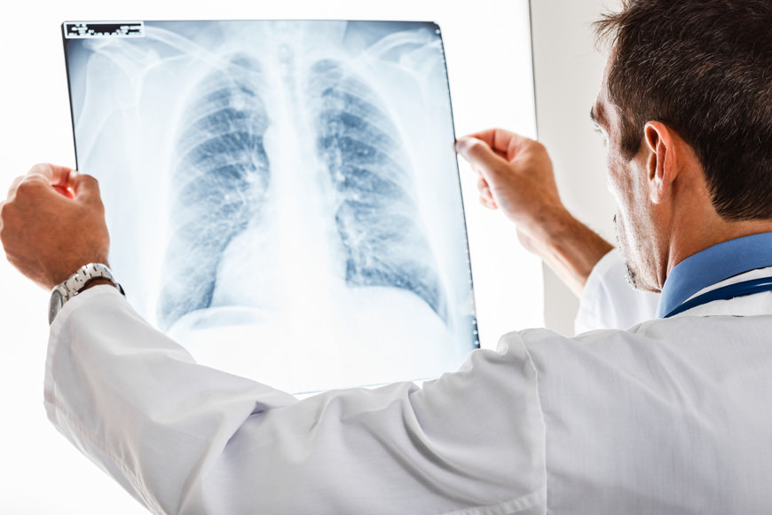 128 de cazuri de pneumonie într-o săptămână