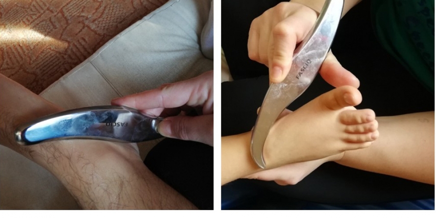 Terapia fasciq la Asociația Esperando