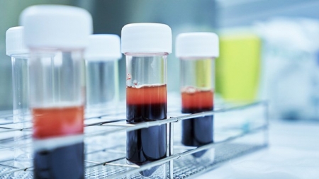 Coreea de Sud va trimite 2.000.000 de teste pentru coronavirus în România; anunțul autorităților române