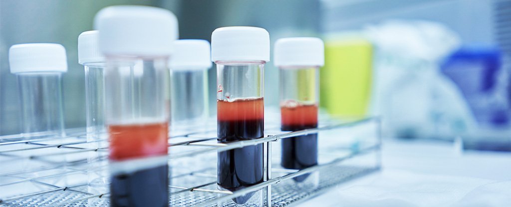 Coreea de Sud va trimite 2.000.000 de teste pentru coronavirus în România; anunțul autorităților române