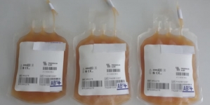 Noi condiții pentru donarea de sânge total/plasmă de la persoanele vindecate de COVID-19