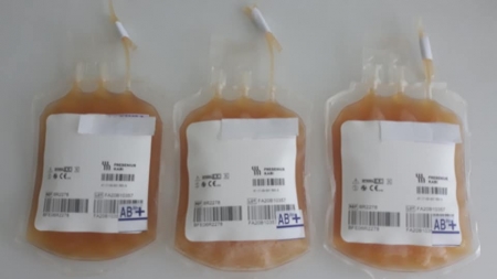 Noi condiții pentru donarea de sânge total/plasmă de la persoanele vindecate de COVID-19