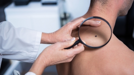 În ultimele șase luni, mii de pacienți cu probleme dermatologice au fost consultați la Spitalul Județean Baia Mare
