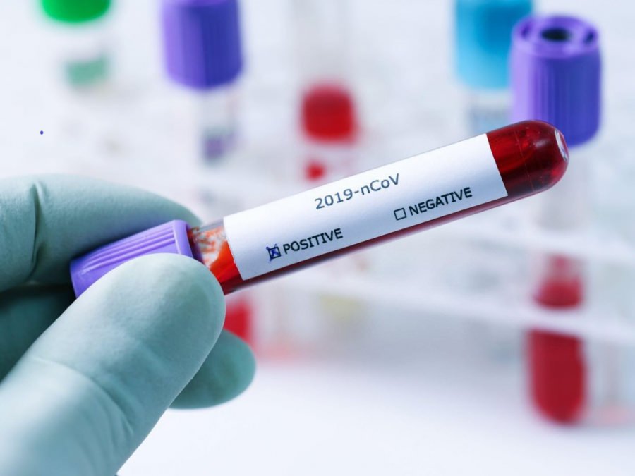 COVID-19: Focar la un centru rezidențial din Sighetu Marmației. Șapte angajați testați pozitiv cu noul coronavirus