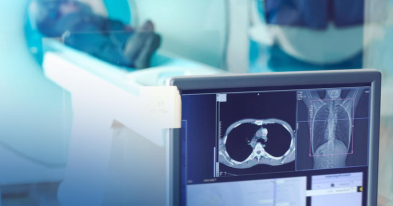 Când este recomandată examinarea Computer Tomograf (CT) în cazul pacienților COVID-19?