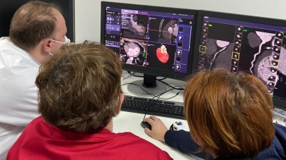 La Spitalul Județean Baia Mare a fost efectuată prima investigație Angio-CT-Coronariană (FOTO)