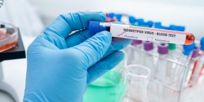 Variola maimuţei: OMS declară urgență globală de sănătate publică, cel mai înalt nivel de alertă