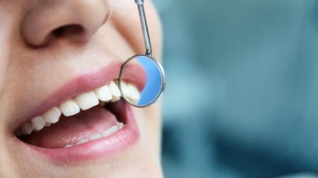 Implantul și profilaxia dentară: soluții eficiente pentru un zâmbet sănătos și frumos