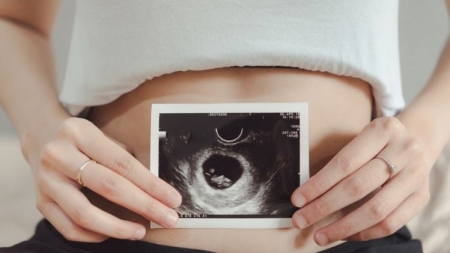“Școala mamei”: La Spitalul Județean Baia Mare se reiau cursurile de pregătire a gravidei pentru naștere și lăuzie