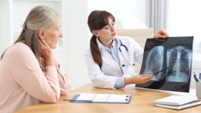 Cancer pulmonar: cauze, simptome, diagnostic și tratament