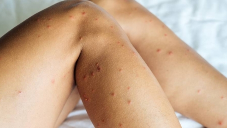 Ploșnițe, răni și spital: ce se ascunde în trenurile CFR din România