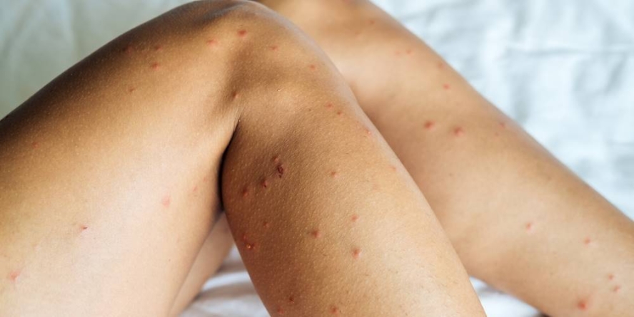 Ploșnițe, răni și spital: ce se ascunde în trenurile CFR din România